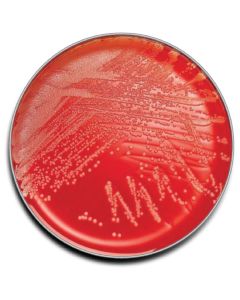 TSA 5% SHEEP BLOOD AGAR 10/PK